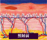 照射前